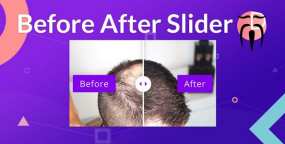 [2.2.2]Divi Sensei Before After Slider照片图片前后对比滑块Divi模块